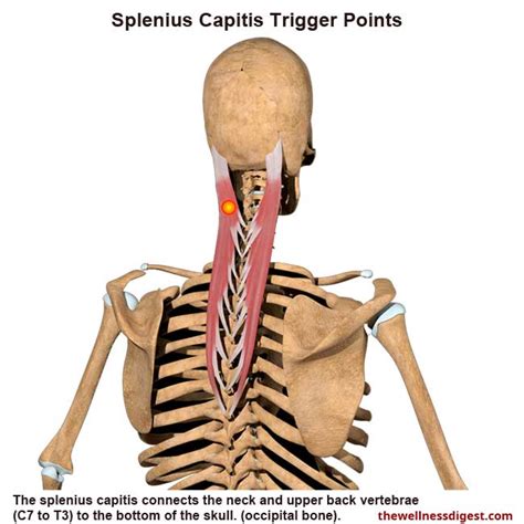 Splenius Capitis Muscle: Pain At The Top Of The Head - The Wellness Digest