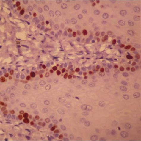 Immunohistochemical Expression Of Ki 67 In Normal Oral Mucosa Download Scientific Diagram