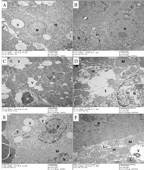 Electron microscopic pictures for the zona fasciculata cells of the ...