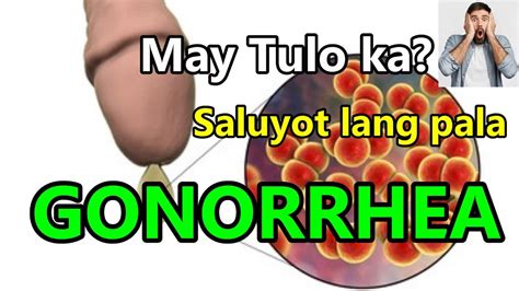 May Problema Ka Sa Tulo Gonorrhea Saluyot Lang Yan Youtube