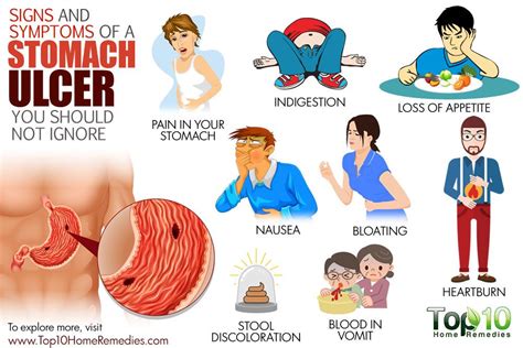 Signs And Symptoms Of A Stomach Ulcer You Should Not Ignore Stomach Ulcers Ulcers Ulcer Symptoms