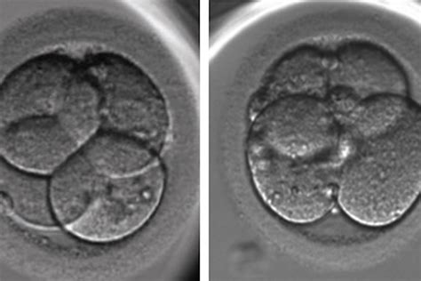 Embryo Evaluation Part 2 Cleavage Stage Embryos Fertility Matters Canada