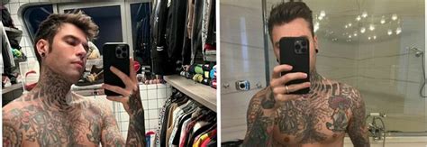 Fedez Ho Perso Quasi Kg Dopo L Operazione Su Instagram Il Selfie