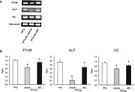 Expression Of Osteoblastic Regulatory Genes In Rat Tibia Examined By