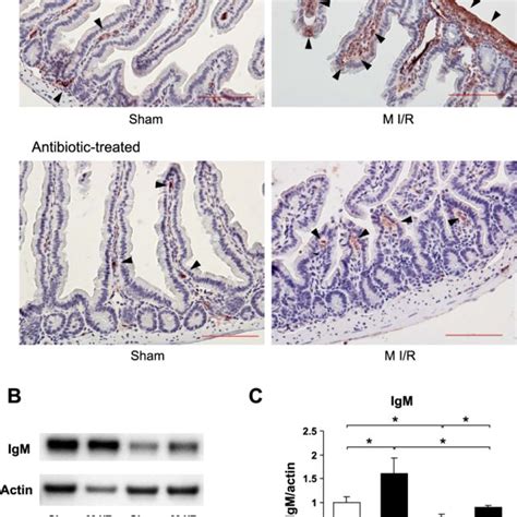 Depletion Of Gut Commensal Bacteria Attenuated Intestinal Injury