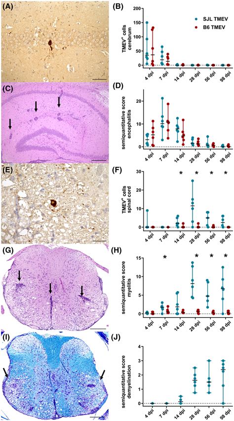 Viral Load Inflammation And Demyelination In Theiler S Murine