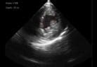 Auto FAC And Quality Grading For Cardiac Ultrasound By RSIP Vision