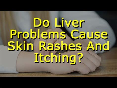 Do Liver Problems Cause Skin Rashes And Itching? - YouTube