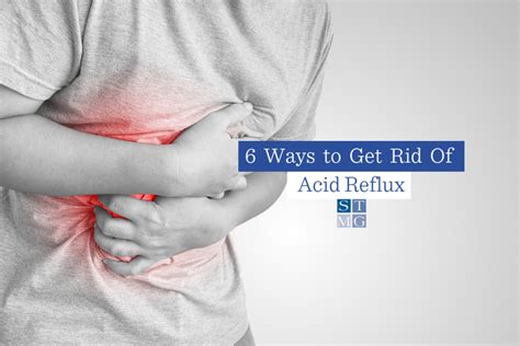 Ways To Get Rid Of Acid Reflux St Thomas Medical Group