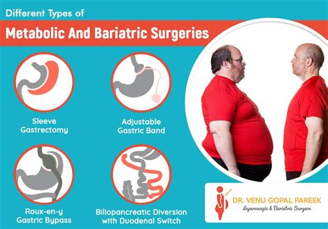 Different Types Of Metabolic And Bariatric Surgeries