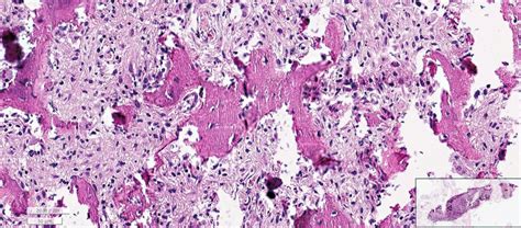 Histologic Findings Hematoxylin And Eosin Staining X20 Of The