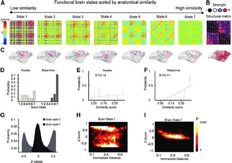 Ketamine Effects On Cortical Dynamical Correlations A Seven Brain