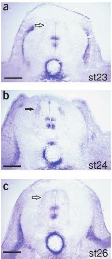 Hip Is Expressed Transiently By Commissural Neurons During The Time