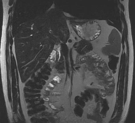 IRM abdominale | Diamorphos, imagerie médicale à Brest