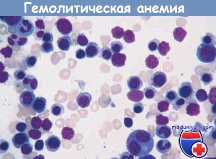 Иммунный Rh-ответ. Эритробластоз плода - гемолитическая болезнь ...