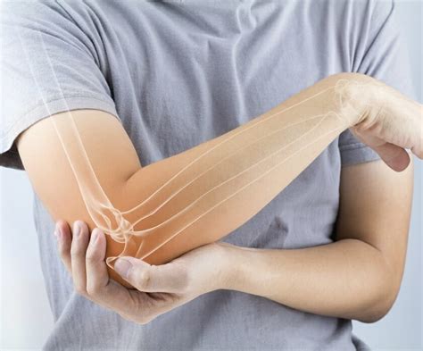 Elbow Tendinitis Brighton Physio Clinic