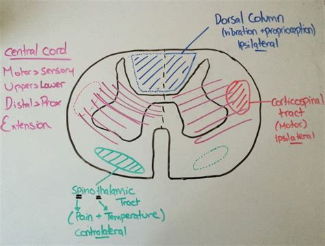 A Boring Guide To Spinal Cord Syndromes