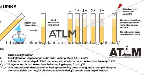 Pemeriksaan Protein Urin Dengan Pemanasan Online Text Book ATLM