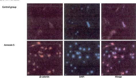 EFFECTS OF Wnt β CATENIN SIGNALING PATHWAY AND STAR D7 ON