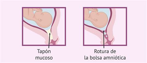 La Importancia Del Tap N Mucoso En Tu Embarazo El Blog De Mundo Petit