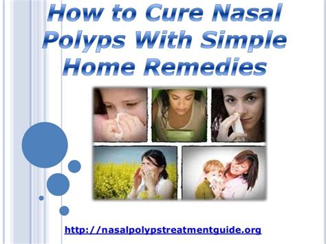 How To Cure Nasal Polyps With Simple Home Remedies