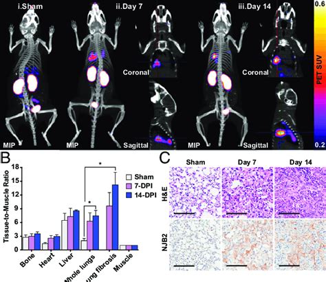 Njb Detects Pulmonary Fibrosis In A Bleomycin Induced Lung Fibrosis