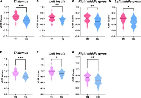 Comparison Of Regional Cerebral Blood Flow Rcbf Values Between The