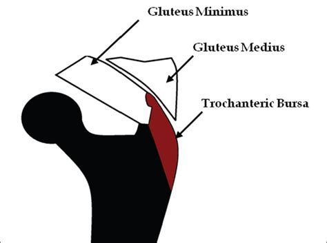 Imaging Of The Bursae Journal Of Clinical Imaging Science