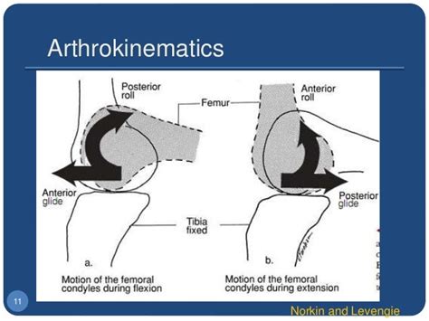 2 Biomechanics Of The Knee Joint Artho Osteo