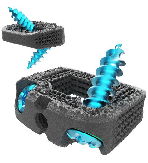 FDA Approves Nexxt Spine S 3D Printed Stand Alone Cervical System