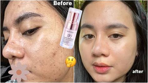 Inilah Produk Skintific Untuk Menghilangkan Flek Hitam Wajah Cerah