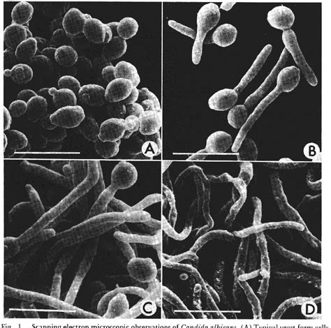 Figure 1 From Modification Of Lipid Composition In A Dimorphic Fungus Candida Albicans During