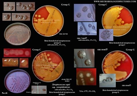 Beta Hemolytical Streptococci Beta Hemolysis On Blood Agar