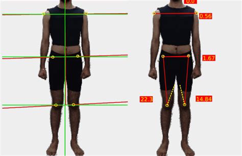 An Effective Posture Assessment Form You Can Use In Your Clinic Auptimo