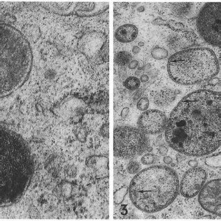 Portion Of Kupffer Cell Containing At Least I0 Lysosomes Of Highly