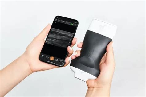 Global Handheld Ultrasound Scanners Market Size Increase By Us