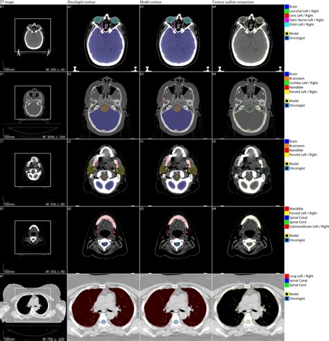 Deep Learning To Achieve Clinically Applicable Segmentation Of Head And