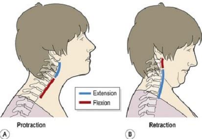 Neck Retraction Exercise | PhysiotherapistMotherwell.com | David Steele