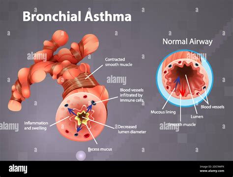 Normal Healthy Lungs Stock Vektorgrafiken Kaufen Seite Alamy