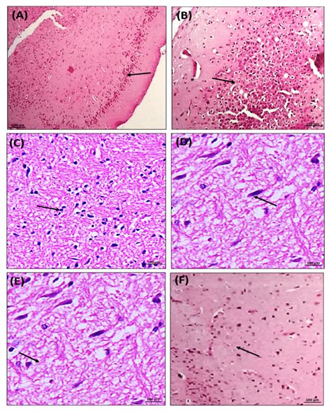 Antiepileptic Effect Of Chondroitin Sulfate On Histomorphological