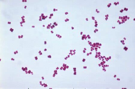 Micrococcus Luteus Gram Stain