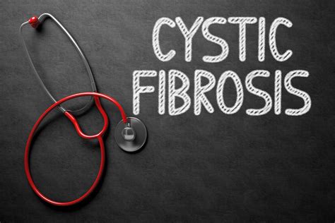 Cystic Fibrosis Treatment Options Detailed In Updated 2018 Genefo Guide