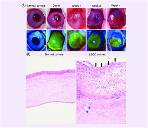 Establishment Of Limbal Stem Cell Deficiency Model After The Ocular