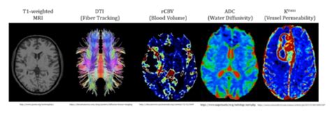 Clinical Applications Of Mri Flashcards Quizlet