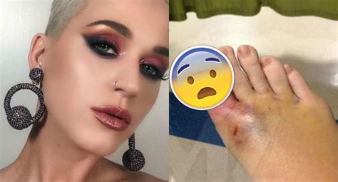 Katy Perry Mujer que perdió un dedo por su culpa la demanda por