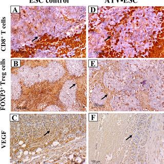 Representative Photomicrographs Of Ihc Stained Immune Cells And Vegf