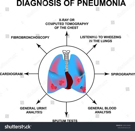 Diagnosis Of Pneumonia Human Respiratory Organs World Pneumonia Day