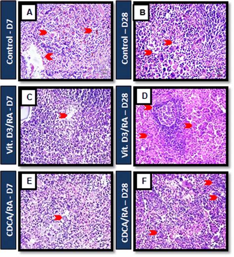 Mouse Infected With L Donovani Splenic Tissue Histological Staining Of Download Scientific