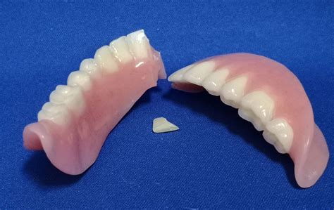 Why Does My Denture Keep Breaking? ... and other denture hazards ...