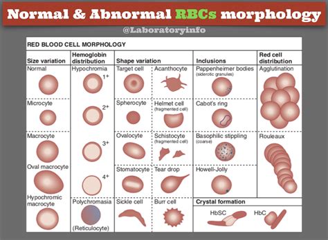 Abnormal Red Blood Cell Chart